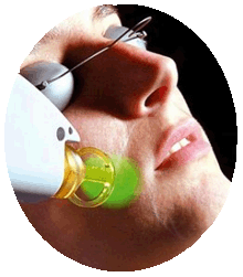 El Dr. Hombre está aplicando el láser en la mejilla de la paciente. El dispositivo emite un haz de luz roja o azul, dependiendo del tipo de terapia. La piel de la paciente refleja suavemente la luz, dando un efecto futurista y profesional.