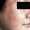 Imagen de primer plano de la piel del rostro la superficie se aprecia seca, con manchas. Lado Derecho