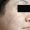 Imagen de primer plano de la piel del rostro se aprecia una mejoría del color y la superficie. Lado derecho