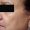 Imagen de primer plano de la piel del rostro la superficie se aprecia seca, con manchas