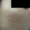 imagen de piel de la mejilla la superficie se observa con manchas que destacan por diferencia del color natural de la piel normal
