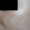 Imagen de la piel del rostro se observa mejoría del color por desaparición de manchas