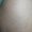 imagen de primer plano de piel en la zona del muslo en que el tatuaje ha desaparecido