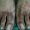 Caso 5. Inicio. Imagen de parte superior de los pies, la piel se observa con manchas de color oscuro