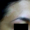 Caso 11. Inicio. Imagen del rostro donde se aprecia lesión ovalada en piel con un color más rojizo que la piel sana