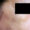Imagen de primer plano de la piel del rostro se aprecia opaca y reseca